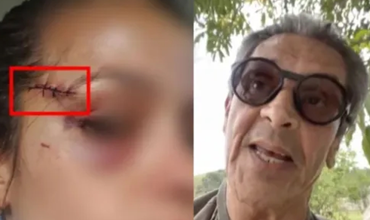 Policial federal ferida por Roberto Jefferson pede indenização de R$ 1 milhão