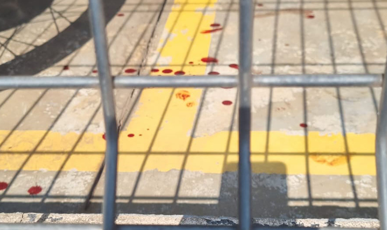 Homem perde dedo ao furtar supermercado em Rolândia
