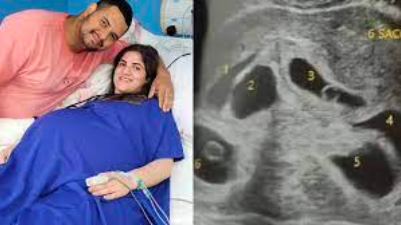 Mãe dá à luz a sêxtuplos em parto de apenas 10 minutos